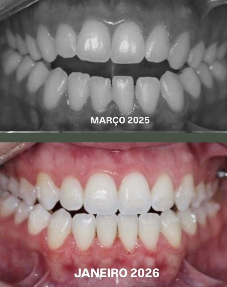 Caso 1 — antes e depois do tratamento